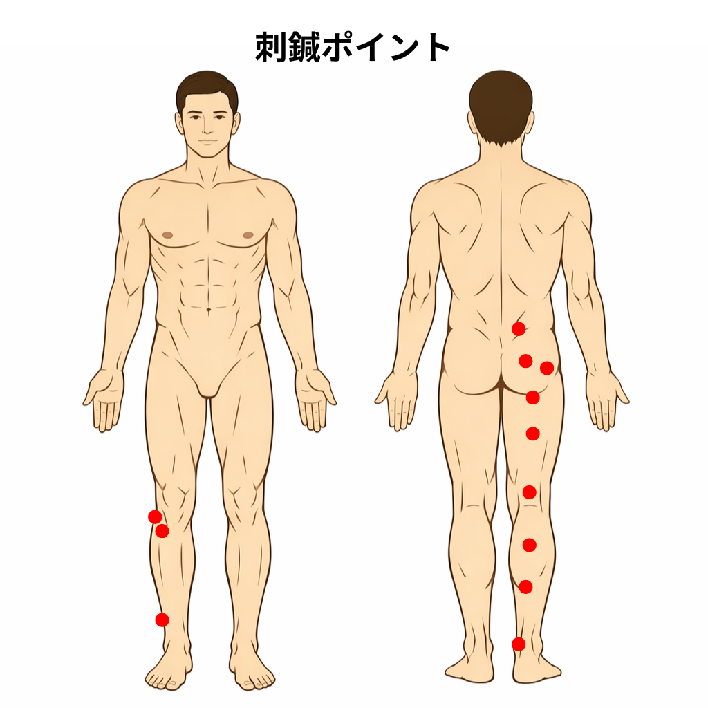 坐骨神経痛の経穴イラスト